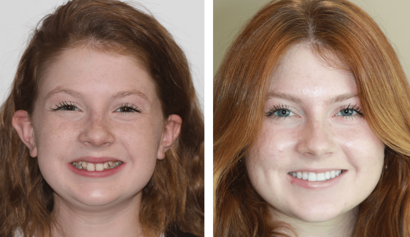 Premier Orthodontic Patient Program Williams Dental & Orthodontics