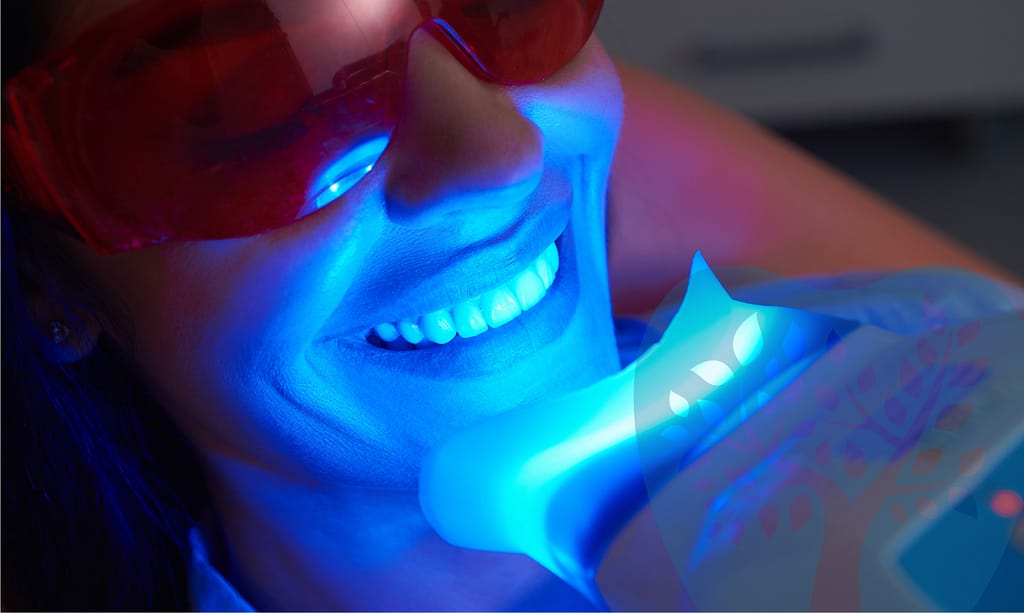 Best teeth whitening treatments.