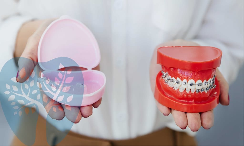 invisalign-vs-braces Invisalign vs. traditional braces