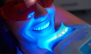Best teeth whitening treatments.