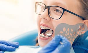 Early intervention orthodontics for kids.