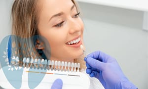 Restore your smile with dental veneers.