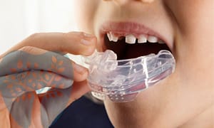 Get a straight smile with Myobrace.