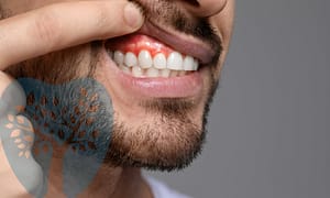 Laser gum surgery may be your best option.