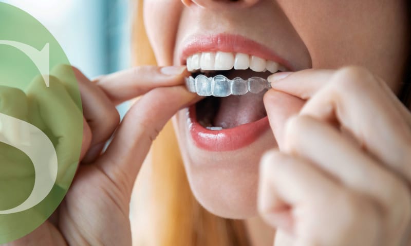Straighten your teeth with Invisalign.