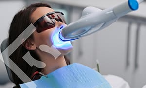 Professional teeth whitening.