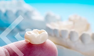 Dental crowns save teeth.