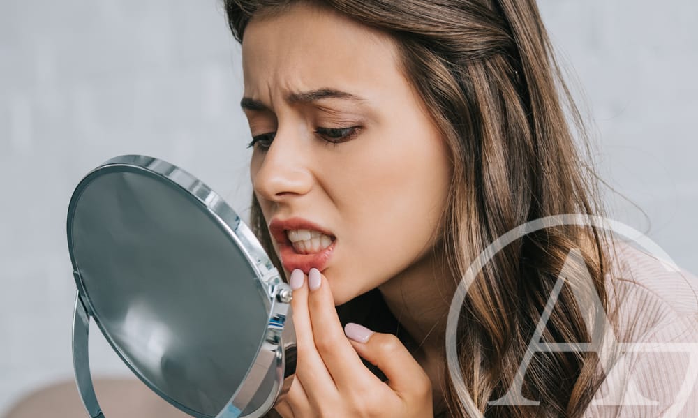 Ten Things to Know Before Getting Dental Veneers