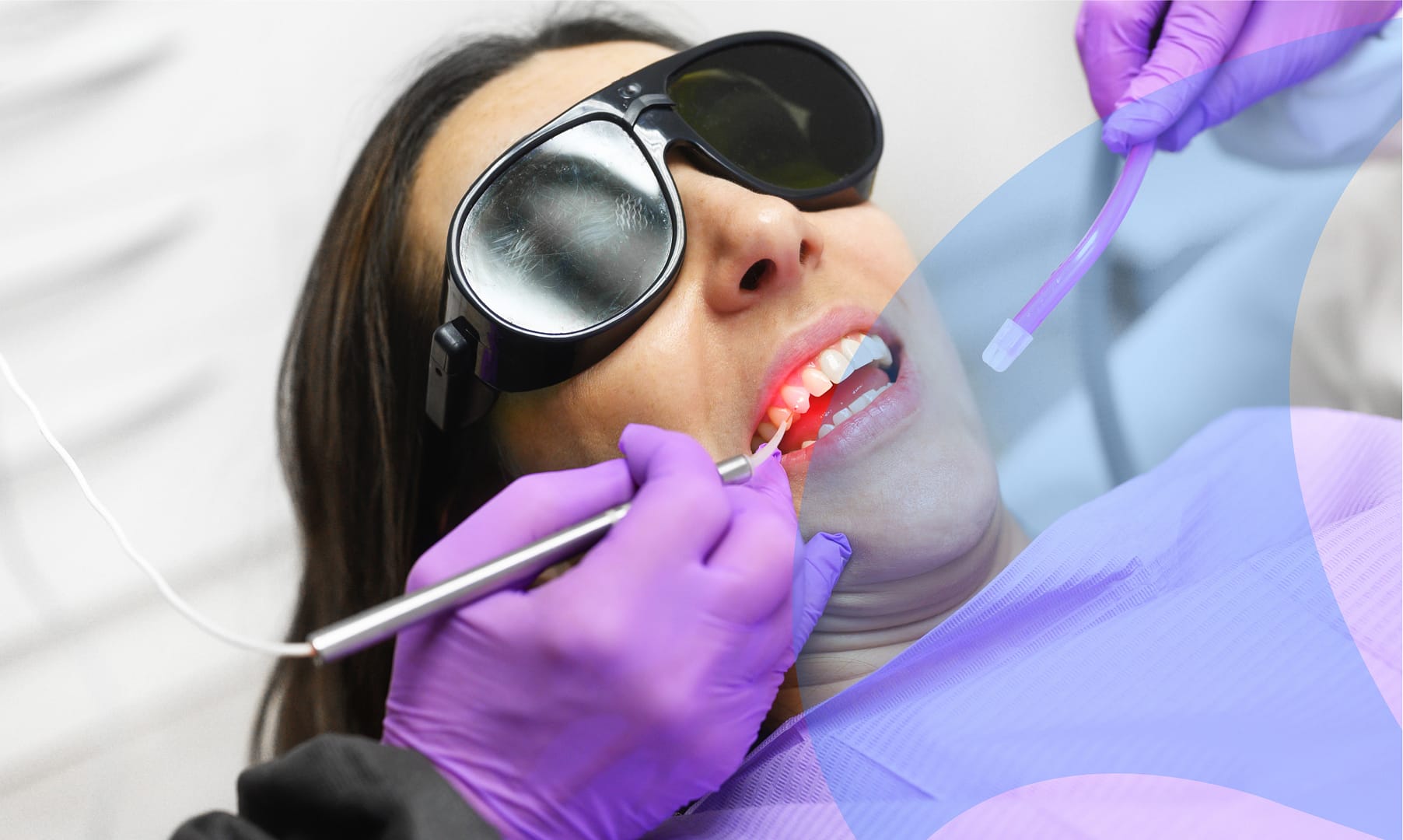 A laser frenectomy can resolve a tongue tie.