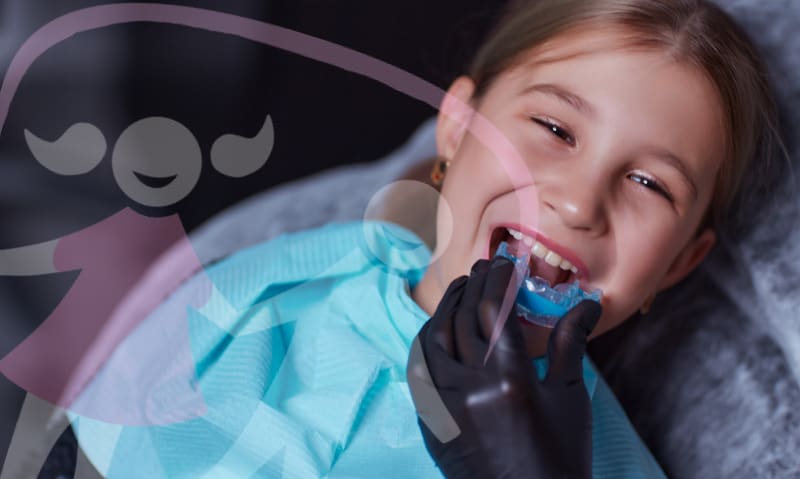 Time for a custom-fit mouthguard