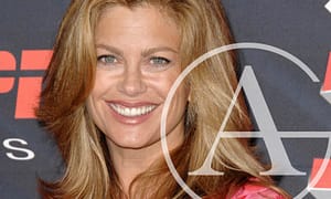 5 Famous People, Their Smile Makeover, and Their Story