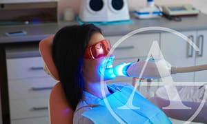 Benefits of tooth whitening.
