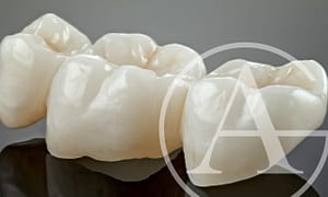 Restore your smile with dental crowns.