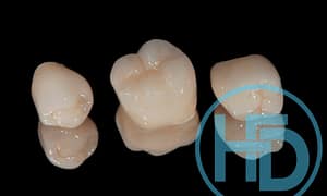 Save your teeth with same day crowns.