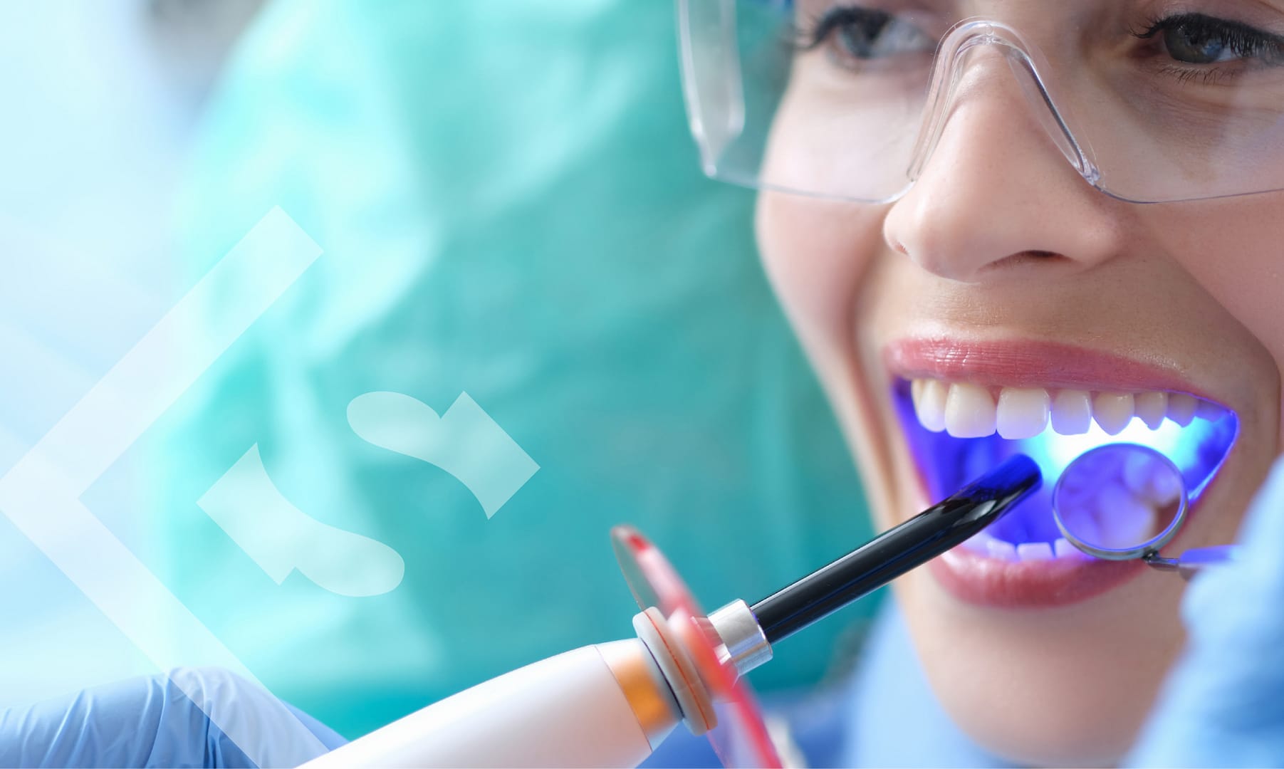 What Is Composite Bonding? 5 Frequently Asked Questions