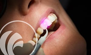 Laser dentistry for gum disease treatment.