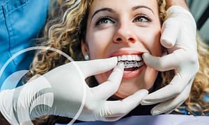 Get straight teeth with clear aligners.