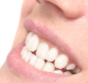 close up photo of person's mouth with jutted tooth