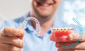 Choose the best orthodontic treatment option.