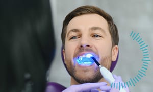 Tooth fillings can save teeth.