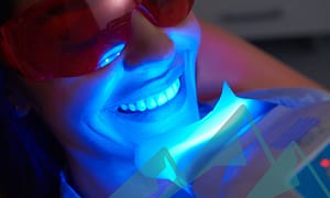 The truth about tooth whitening.