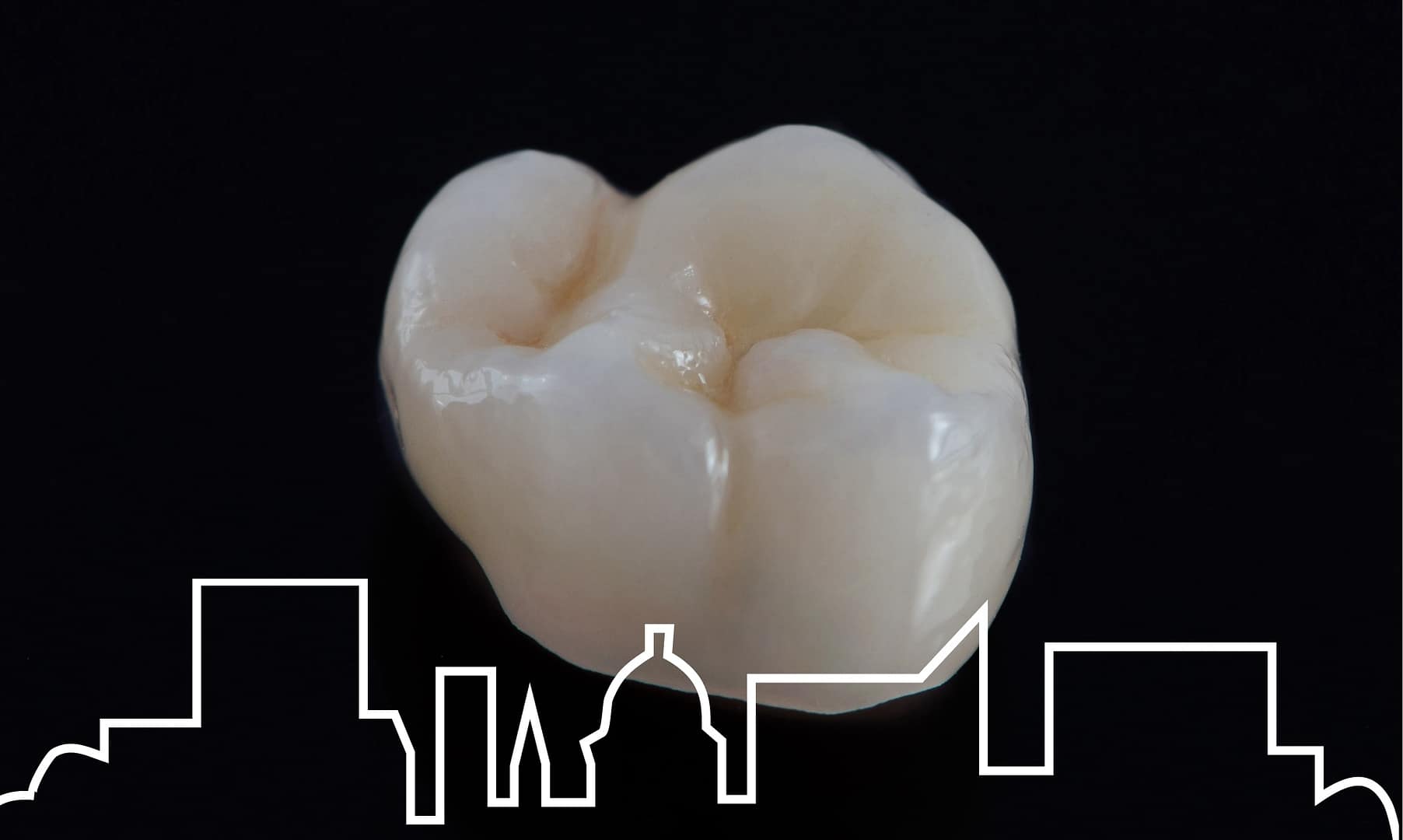 CEREC Crowns Crowning Glory in a Single Visit