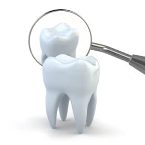 Preventing tooth decay in your family