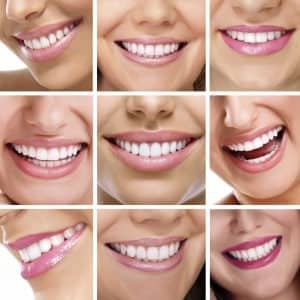 Cosmetic Dentistry Benefits