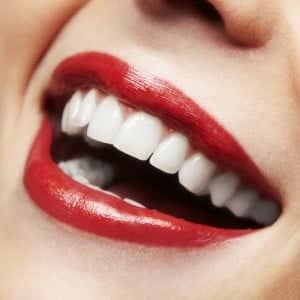 Are Veneers for You?