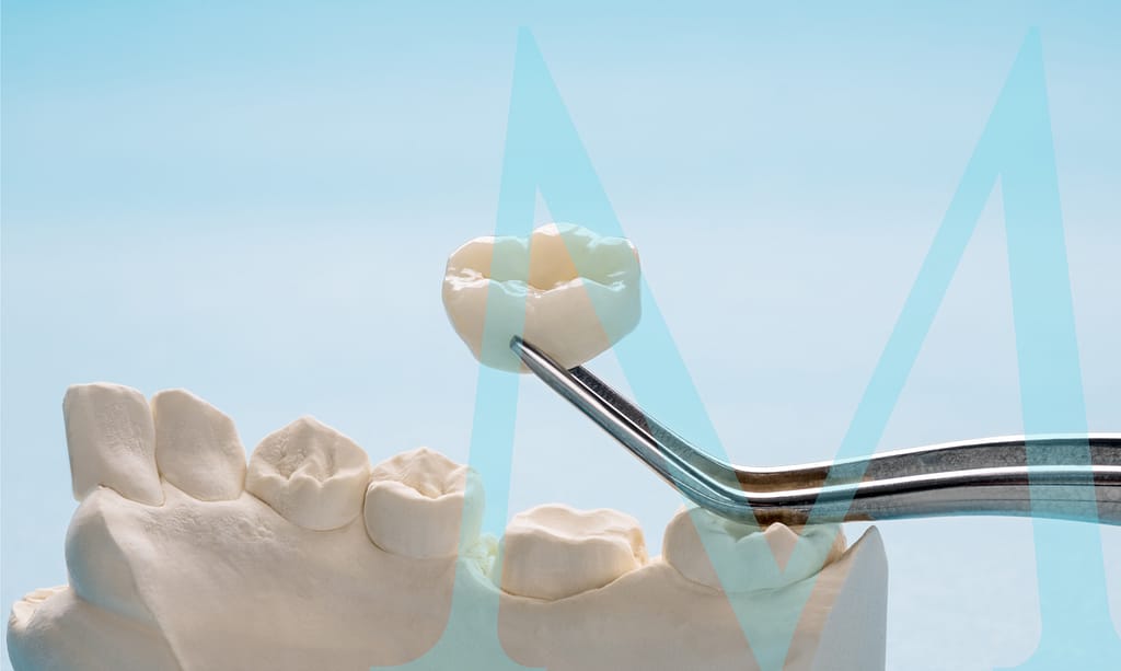 Dental crowns improve oral health.