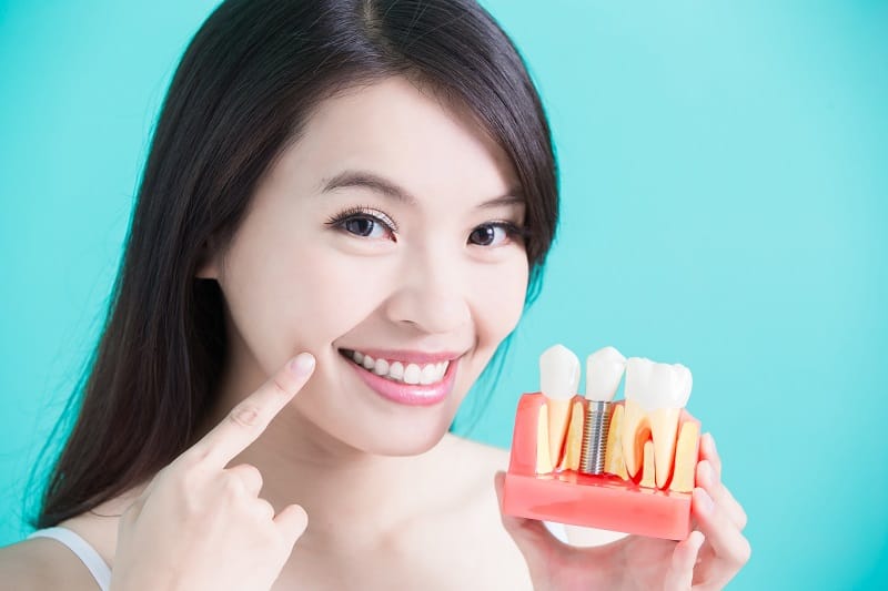 woman take tooth implant false tooth on green background