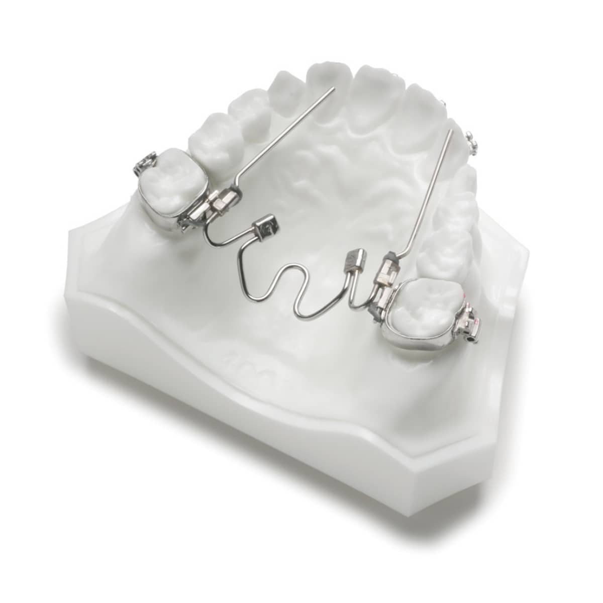 W arch expander - a revolutionary solution for dental arch expansion